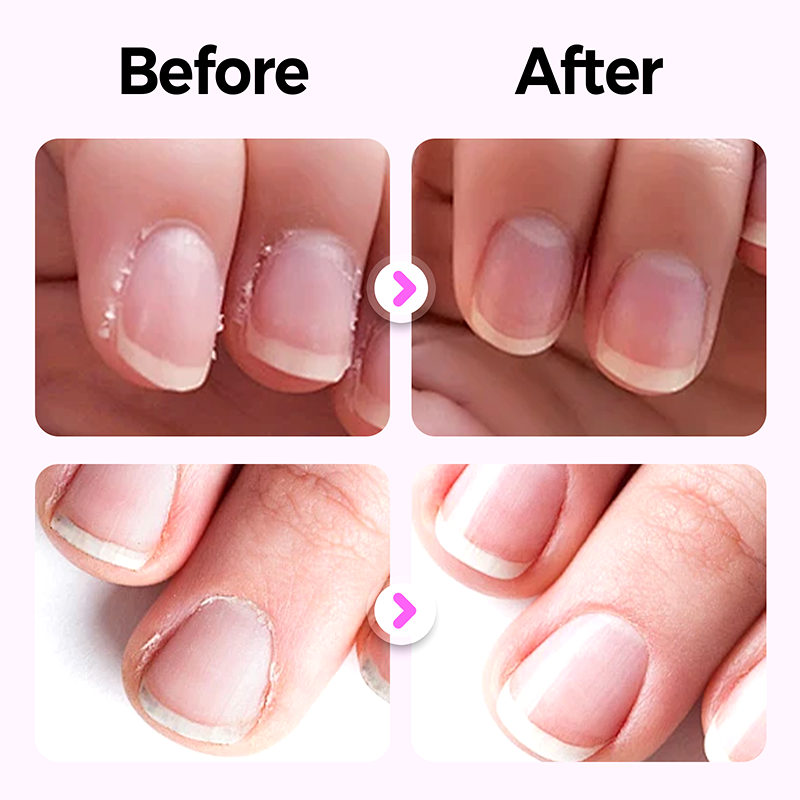 💜2025 Nieuwe verbeterde 3-in-1 nagelverzorgingspen