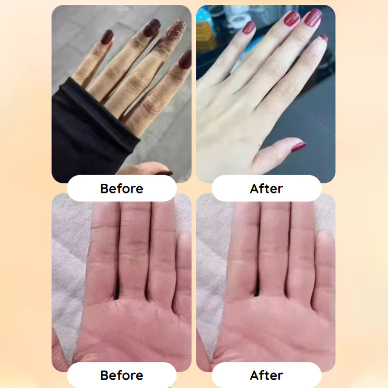 🥳2026 HOT SALE🥳💞50K+ VERKOCHT!💧 🌸50% KORTING Fresh Hydrating Hand Cream – Onmiddellijke verlichting voor droge handen! Diepe hydratatie die langdurig werkt, waardoor de huid de hele dag zacht en soepel blijft. 🌿🤲