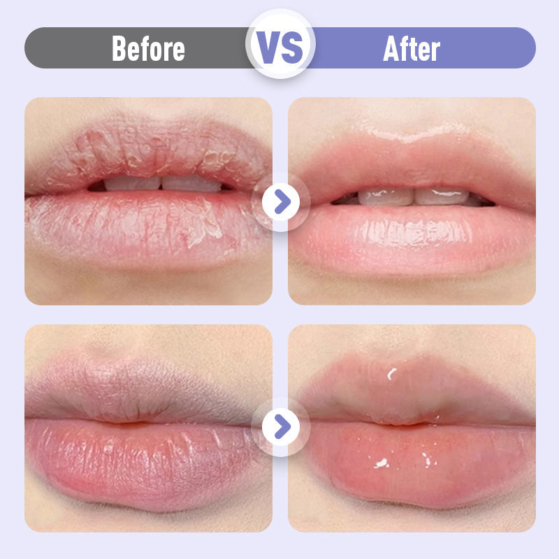 Opvullend en Anti-Rimpel Hydraterend Lippenserum